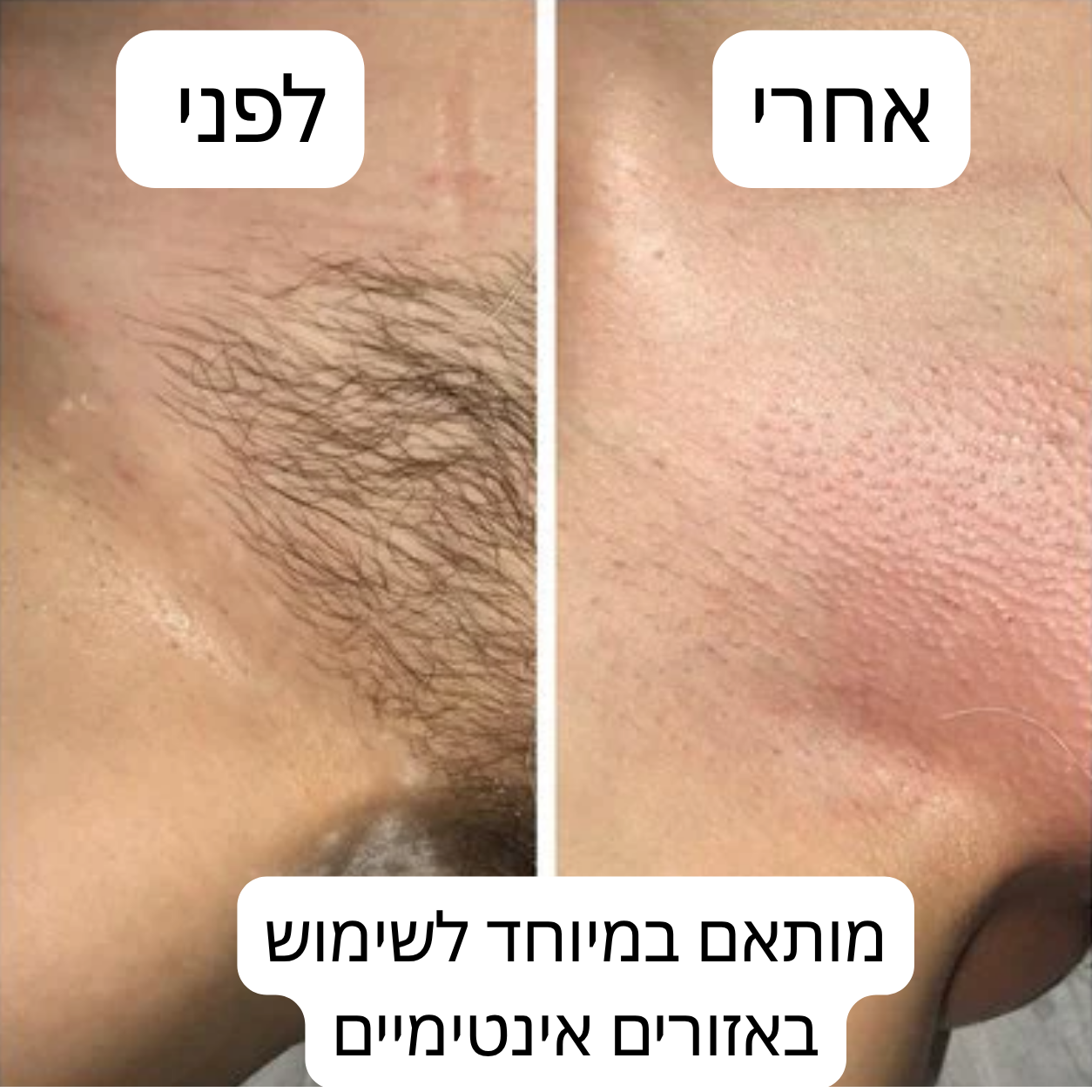 מארז העור החלק של Blue Velvet