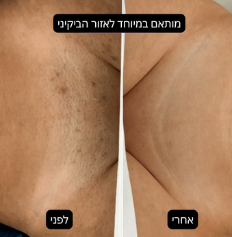 מארז העור החלק של™Blue Velvet
