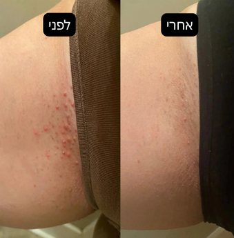 מארז העור החלק של™Blue Velvet